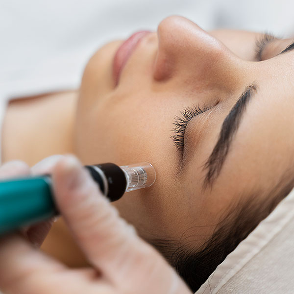 Microneedling